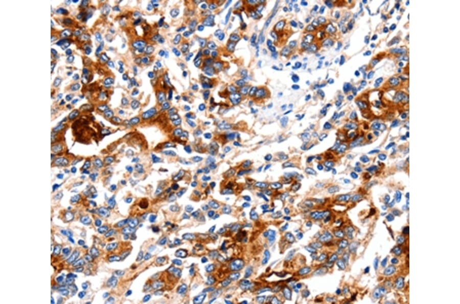 Immunohistochemistry - KLK15 Antibody from Signalway Antibody (35797) - Antibodies.com