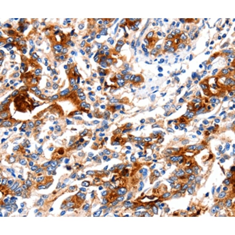 Immunohistochemistry - KLK15 Antibody from Signalway Antibody (35797) - Antibodies.com