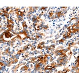 Immunohistochemistry - KLK15 Antibody from Signalway Antibody (35797) - Antibodies.com