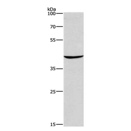 CD207 Antibody from Signalway Antibody (35798) - Antibodies.com