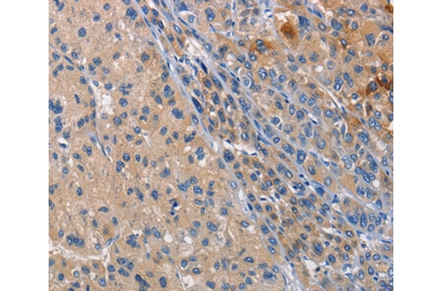 Immunohistochemistry - CD207 Antibody from Signalway Antibody (35798) - Antibodies.com