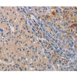 Immunohistochemistry - CD207 Antibody from Signalway Antibody (35798) - Antibodies.com