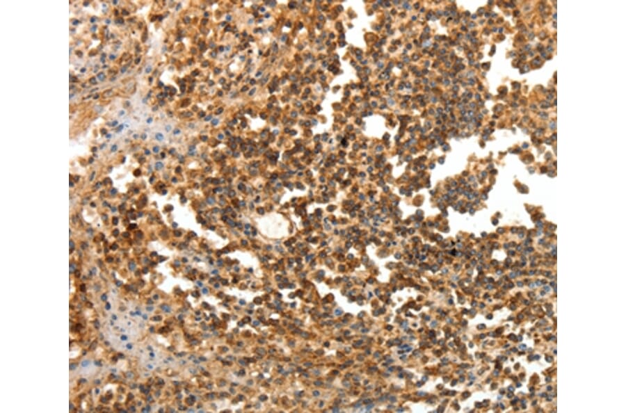 Immunohistochemistry - LRP12 Antibody from Signalway Antibody (35802) - Antibodies.com