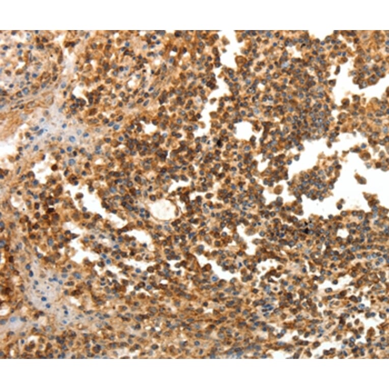 Immunohistochemistry - LRP12 Antibody from Signalway Antibody (35802) - Antibodies.com
