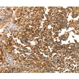 Immunohistochemistry - LRP12 Antibody from Signalway Antibody (35802) - Antibodies.com