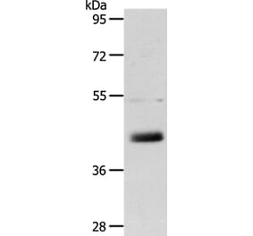 LYVE1 Antibody from Signalway Antibody (35806) - Antibodies.com
