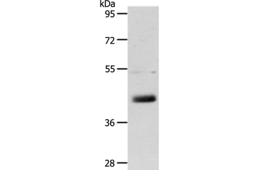 LYVE1 Antibody from Signalway Antibody (35806) - Antibodies.com