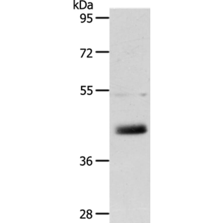 LYVE1 Antibody from Signalway Antibody (35806) - Antibodies.com