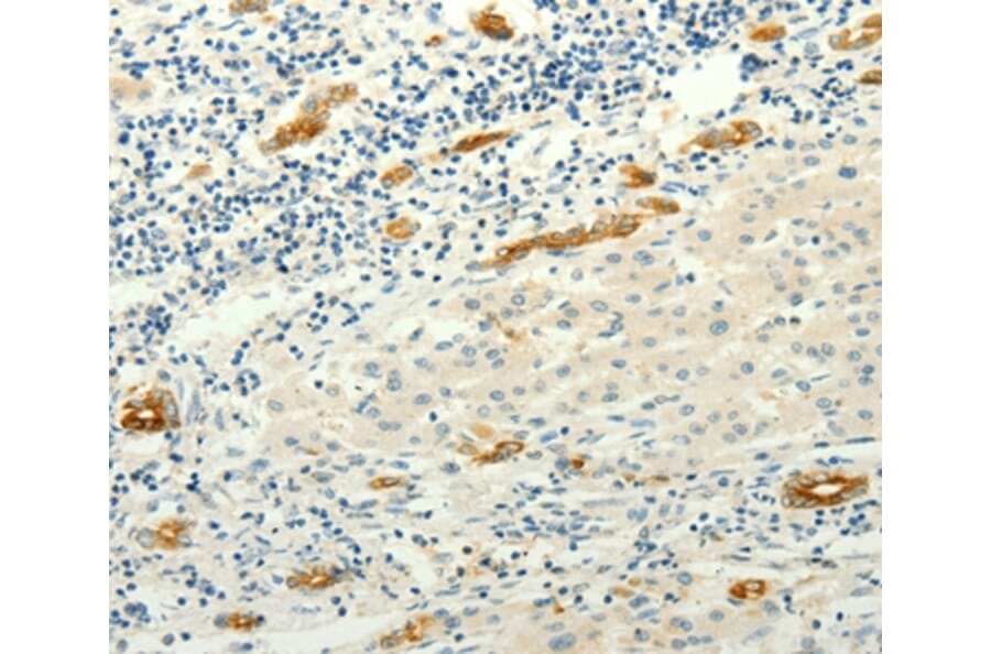 Immunohistochemistry - LYVE1 Antibody from Signalway Antibody (35806) - Antibodies.com