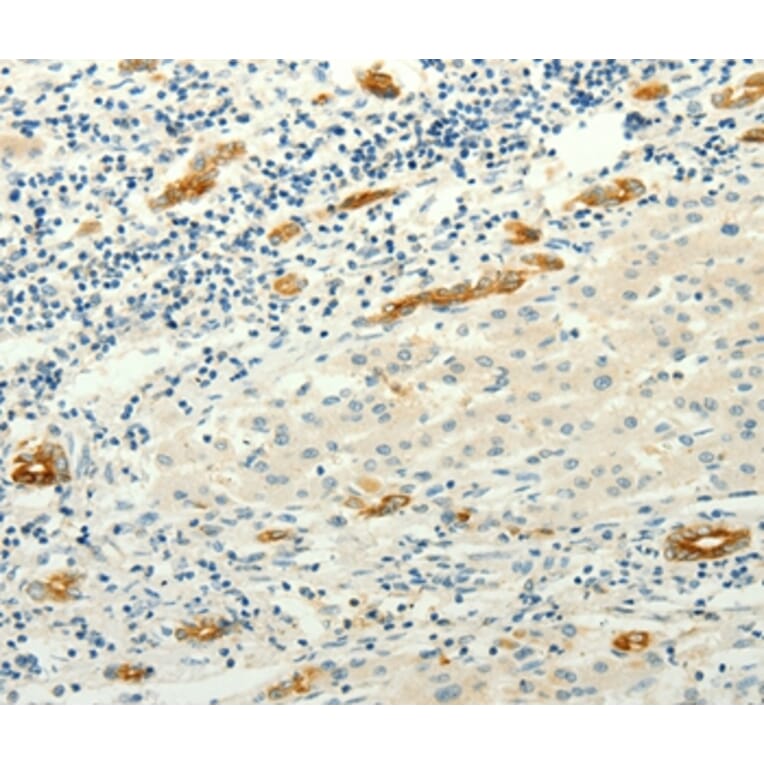 Immunohistochemistry - LYVE1 Antibody from Signalway Antibody (35806) - Antibodies.com