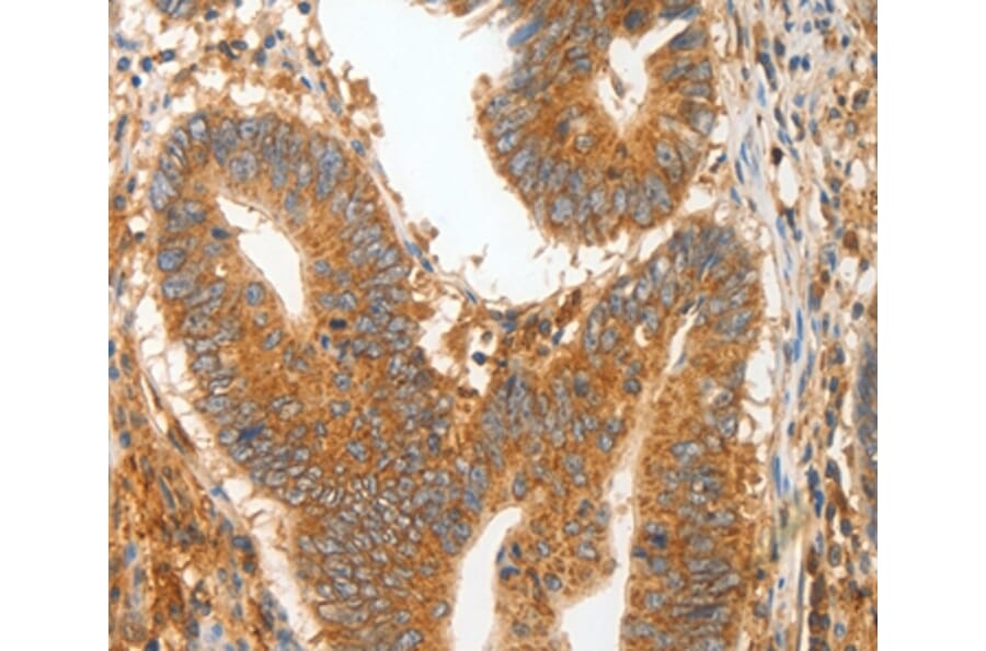 Immunohistochemistry - MMP28 Antibody from Signalway Antibody (35819) - Antibodies.com