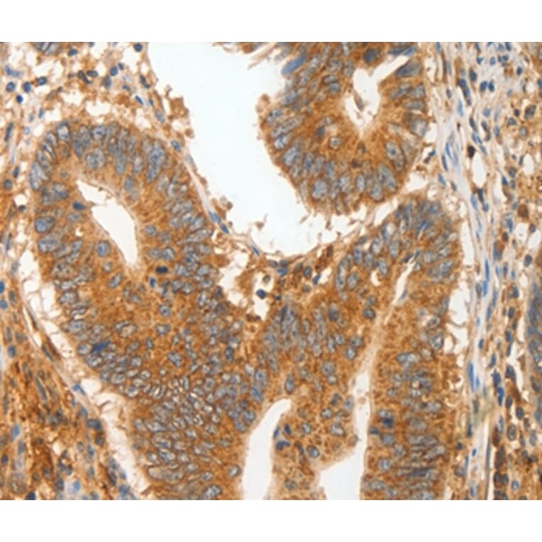 Immunohistochemistry - MMP28 Antibody from Signalway Antibody (35819) - Antibodies.com