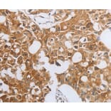 Immunohistochemistry - MUC20 Antibody from Signalway Antibody (35824) - Antibodies.com