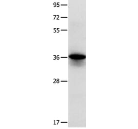 MYOZ1 Antibody from Signalway Antibody (35825) - Antibodies.com