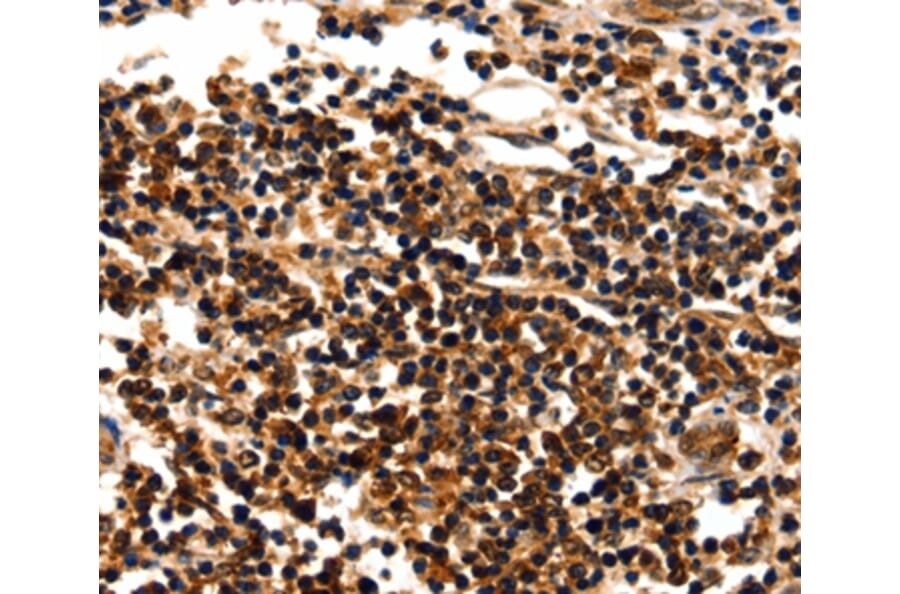 Immunohistochemistry - MYOZ1 Antibody from Signalway Antibody (35825) - Antibodies.com