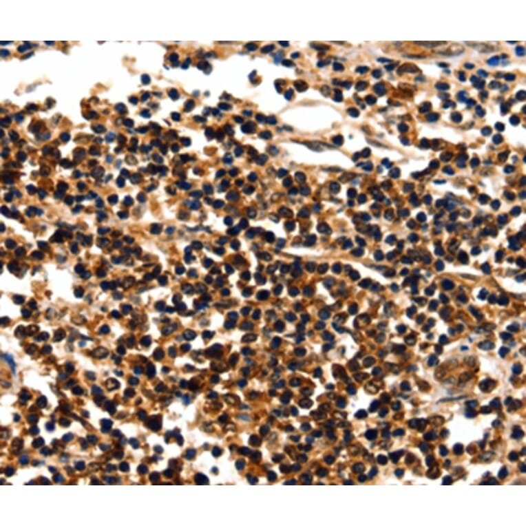Immunohistochemistry - MYOZ1 Antibody from Signalway Antibody (35825) - Antibodies.com
