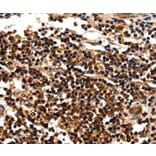 Immunohistochemistry - MYOZ1 Antibody from Signalway Antibody (35825) - Antibodies.com