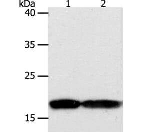 PDCD6 Antibody from Signalway Antibody (35872) - Antibodies.com