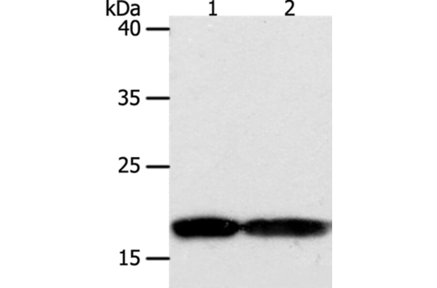 PDCD6 Antibody from Signalway Antibody (35872) - Antibodies.com