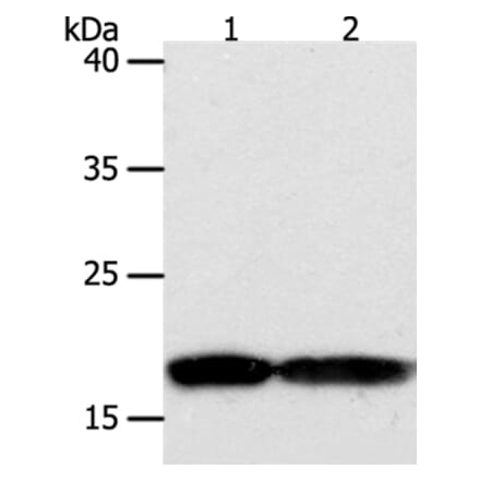 PDCD6 Antibody from Signalway Antibody (35872) - Antibodies.com