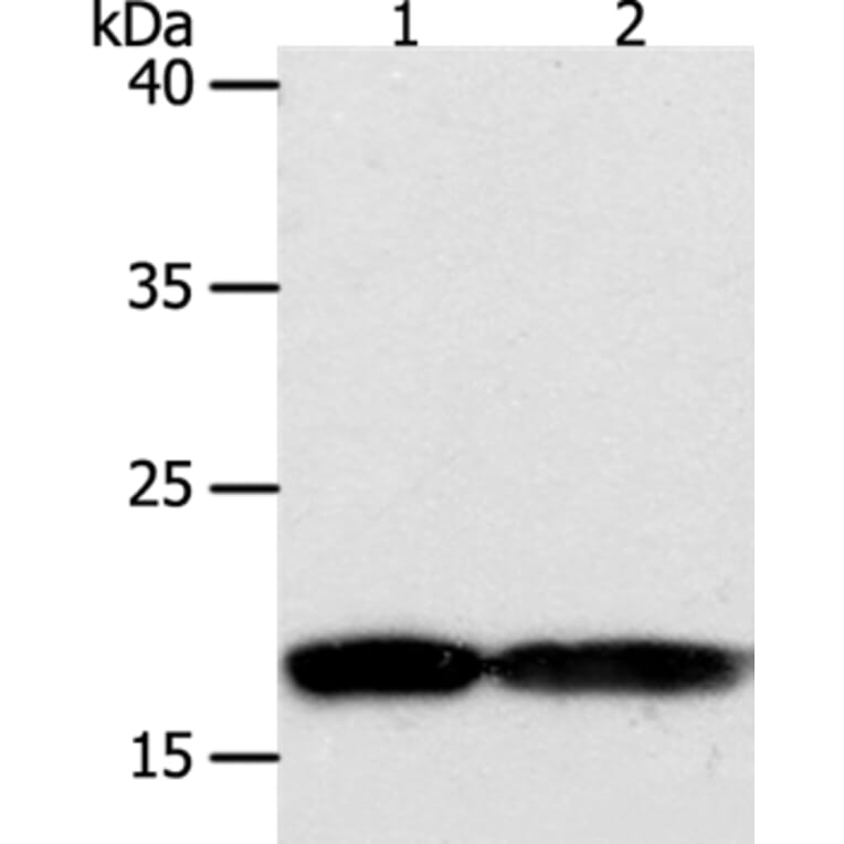 PDCD6 Antibody from Signalway Antibody (35872) - Antibodies.com