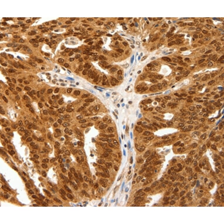 Immunohistochemistry - PDCD6 Antibody from Signalway Antibody (35872) - Antibodies.com