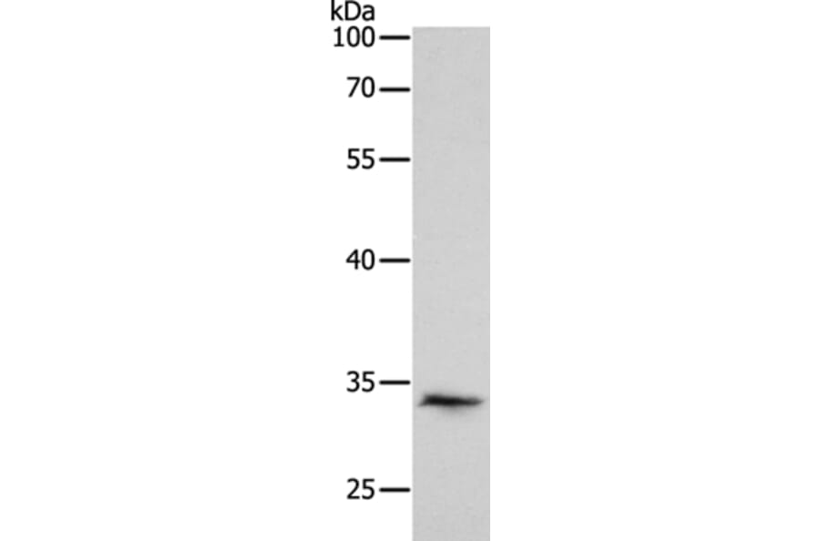 RCHY1 Antibody from Signalway Antibody (35879) - Antibodies.com