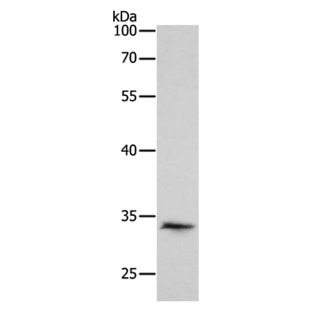 RCHY1 Antibody from Signalway Antibody (35879) - Antibodies.com