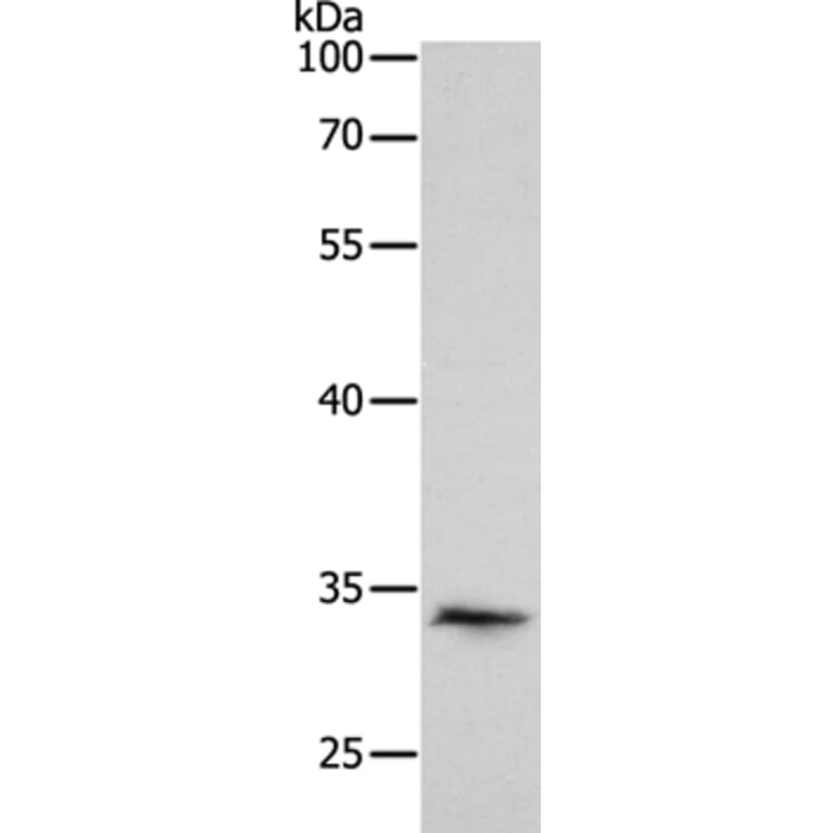 RCHY1 Antibody from Signalway Antibody (35879) - Antibodies.com