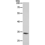 RCHY1 Antibody from Signalway Antibody (35879) - Antibodies.com
