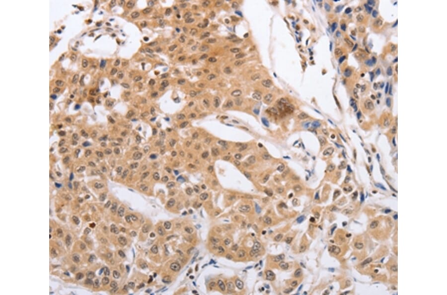 Immunohistochemistry - RCHY1 Antibody from Signalway Antibody (35879) - Antibodies.com