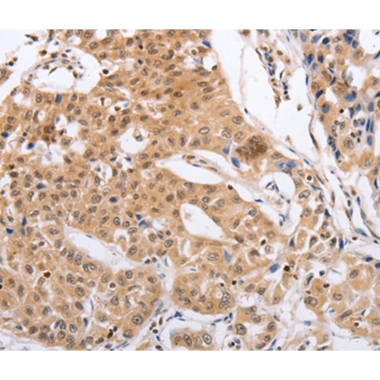 Immunohistochemistry - RCHY1 Antibody from Signalway Antibody (35879) - Antibodies.com
