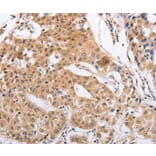 Immunohistochemistry - RCHY1 Antibody from Signalway Antibody (35879) - Antibodies.com