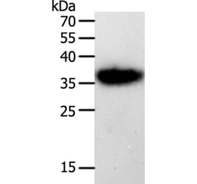 PLAUR Antibody from Signalway Antibody (35883) - Antibodies.com