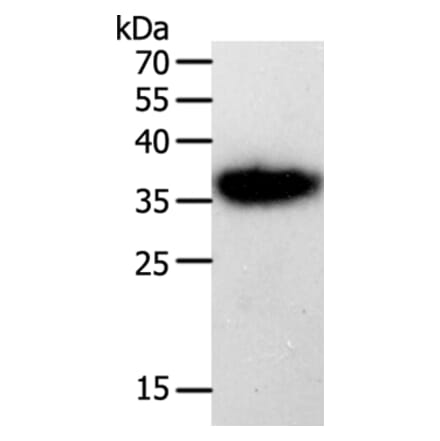 PLAUR Antibody from Signalway Antibody (35883) - Antibodies.com