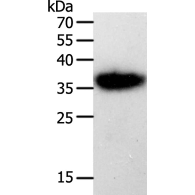 PLAUR Antibody from Signalway Antibody (35883) - Antibodies.com