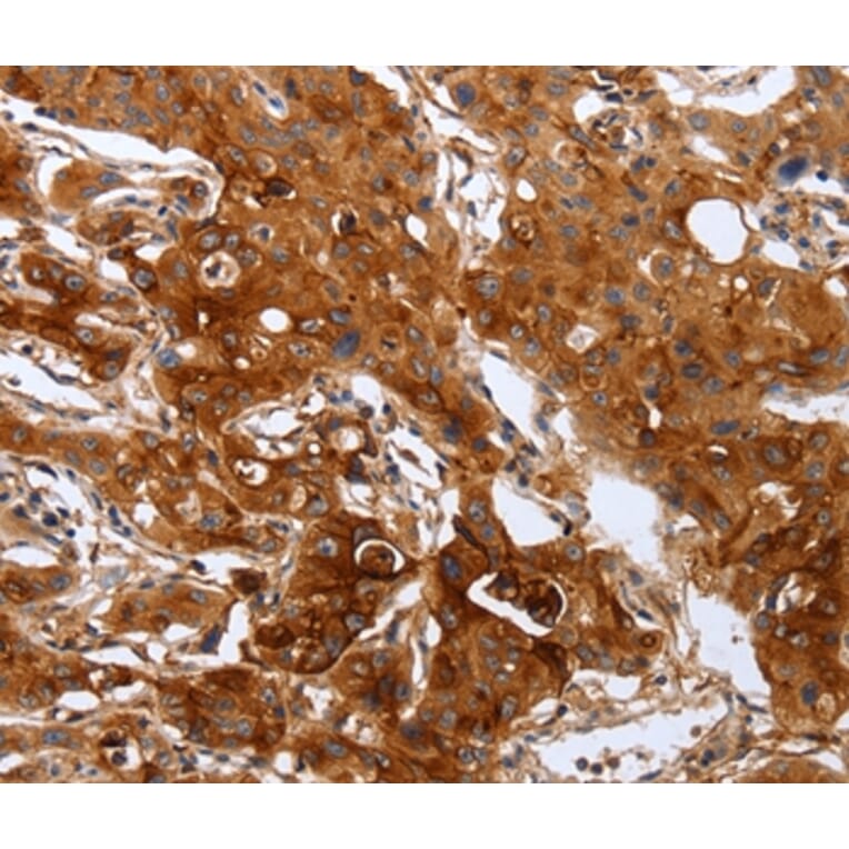 Immunohistochemistry - PLAUR Antibody from Signalway Antibody (35883) - Antibodies.com