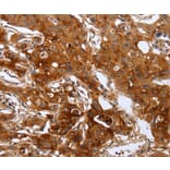 Immunohistochemistry - PLAUR Antibody from Signalway Antibody (35883) - Antibodies.com