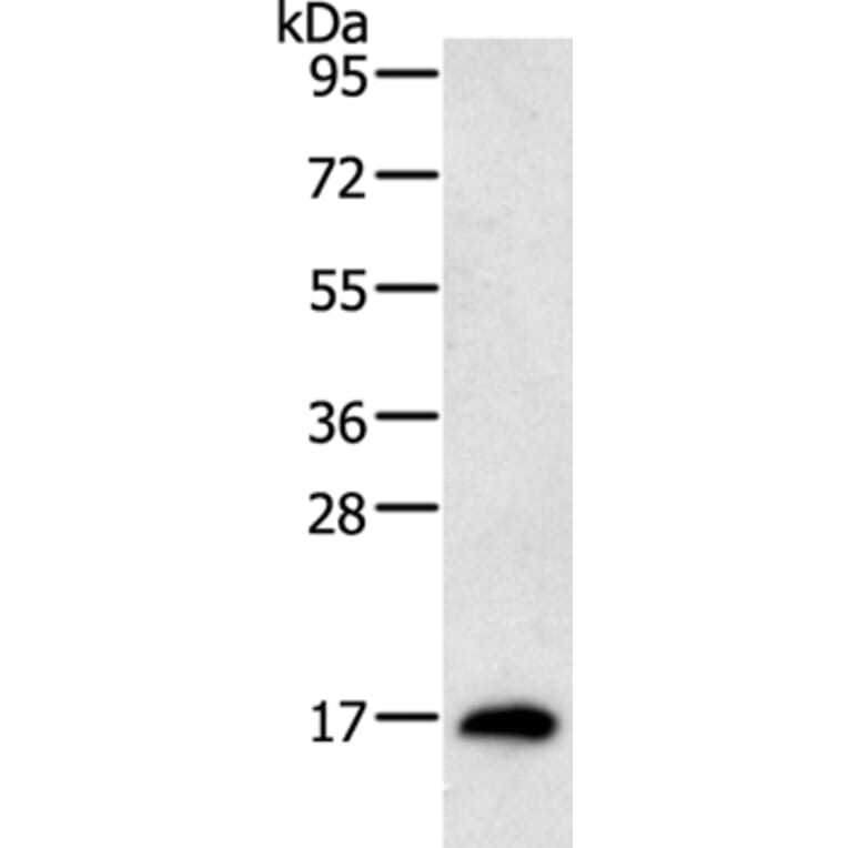 RAMP1 Antibody from Signalway Antibody (35885) - Antibodies.com
