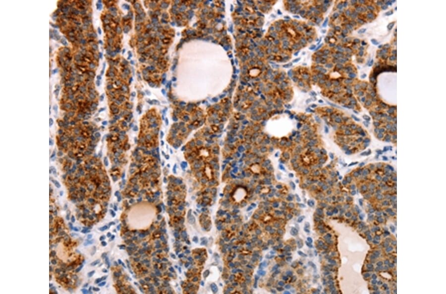 Immunohistochemistry - RAMP1 Antibody from Signalway Antibody (35885) - Antibodies.com