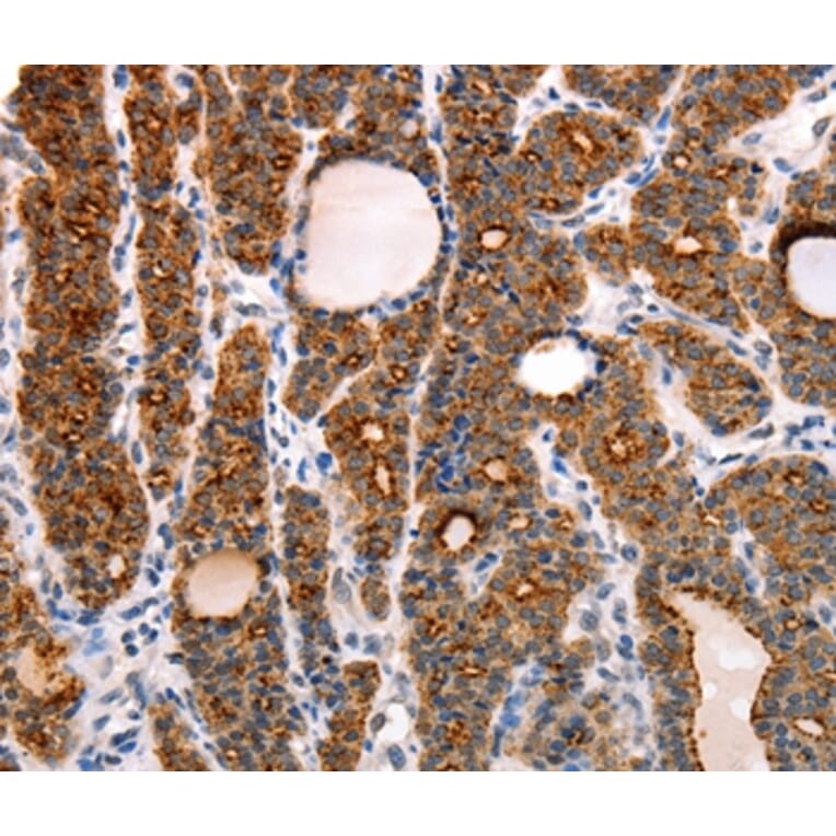 Immunohistochemistry - RAMP1 Antibody from Signalway Antibody (35885) - Antibodies.com