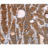 Immunohistochemistry - RAMP1 Antibody from Signalway Antibody (35885) - Antibodies.com