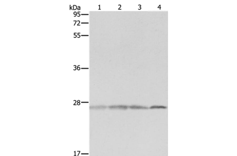 PRDX3 Antibody from Signalway Antibody (35890) - Antibodies.com