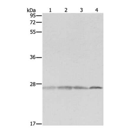 PRDX3 Antibody from Signalway Antibody (35890) - Antibodies.com