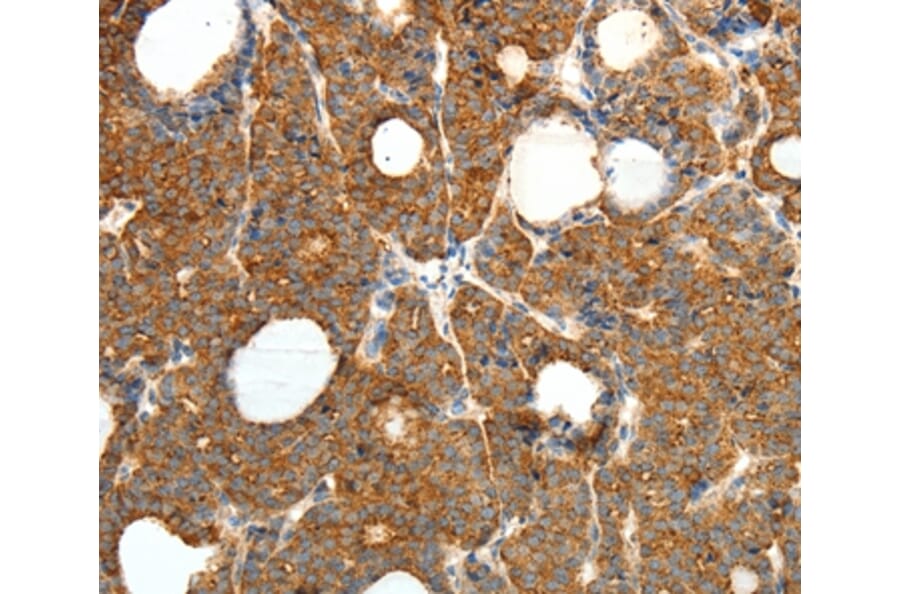 Immunohistochemistry - PRDX3 Antibody from Signalway Antibody (35890) - Antibodies.com