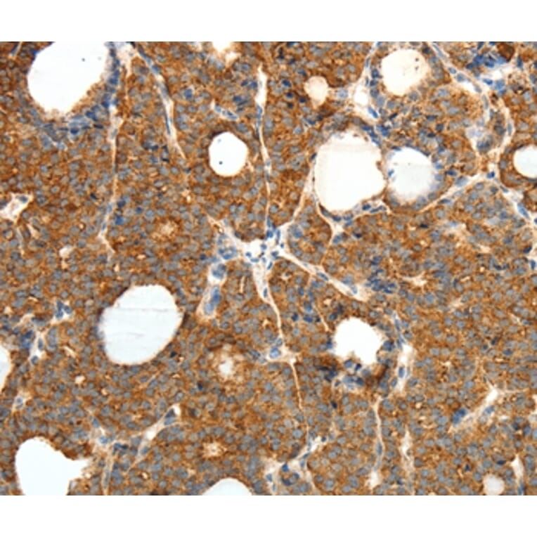 Immunohistochemistry - PRDX3 Antibody from Signalway Antibody (35890) - Antibodies.com