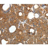 Immunohistochemistry - PRDX3 Antibody from Signalway Antibody (35890) - Antibodies.com