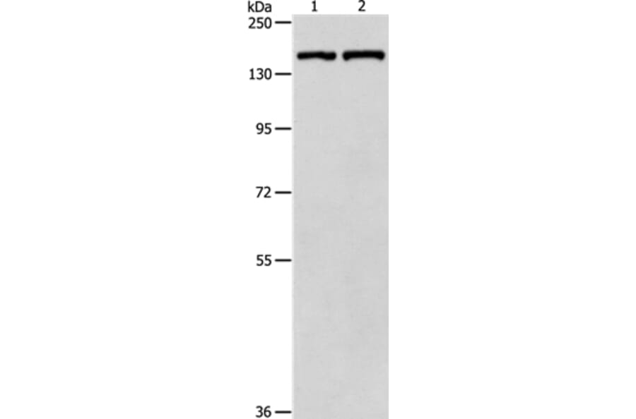 PTCH1 Antibody from Signalway Antibody (35897) - Antibodies.com
