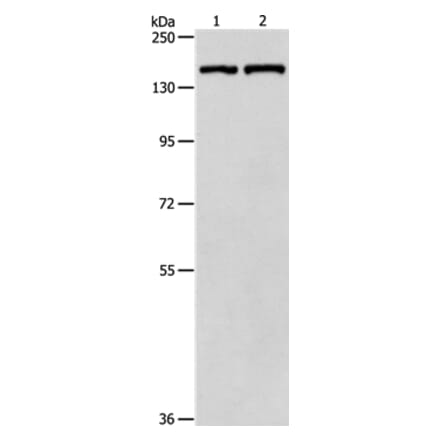 PTCH1 Antibody from Signalway Antibody (35897) - Antibodies.com