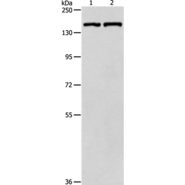 PTCH1 Antibody from Signalway Antibody (35897) - Antibodies.com